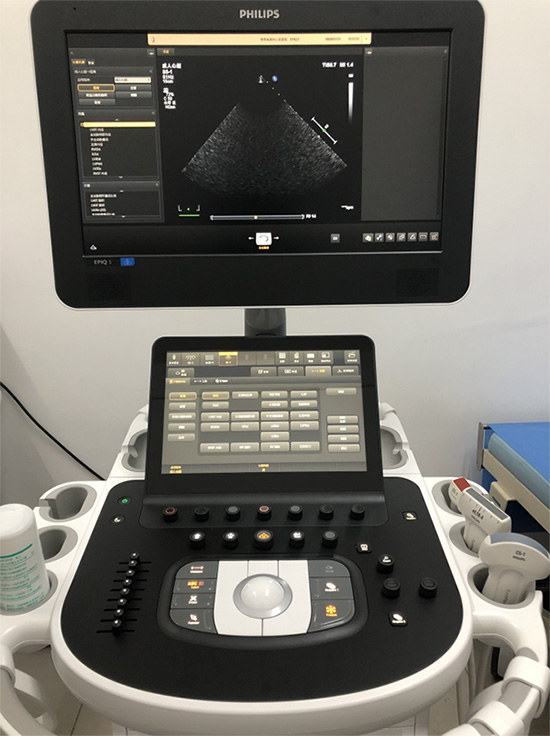 飞利浦EPIQ5高端智能彩超诊断系统