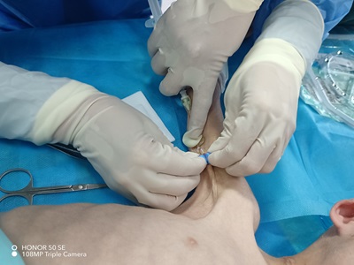 新突破丨亚色视频
儿科二病区开展首例PICC原位换管置管术，为危重症患儿打通“生命通道”